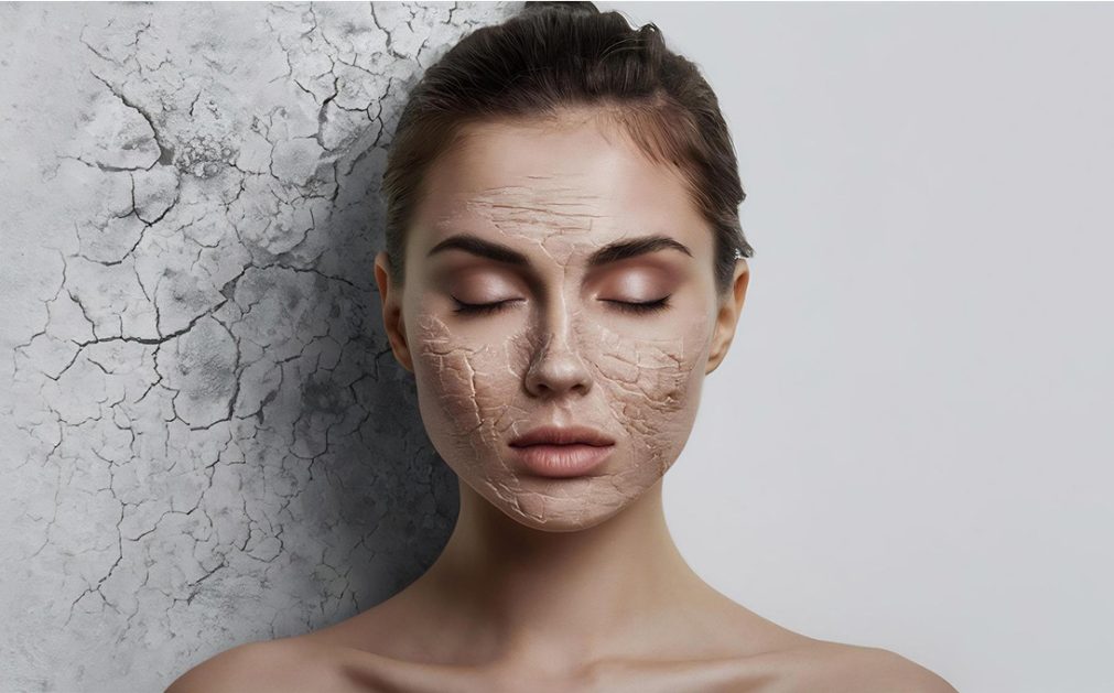 کرم آبرسان قوی برای پوست خیلی خشک